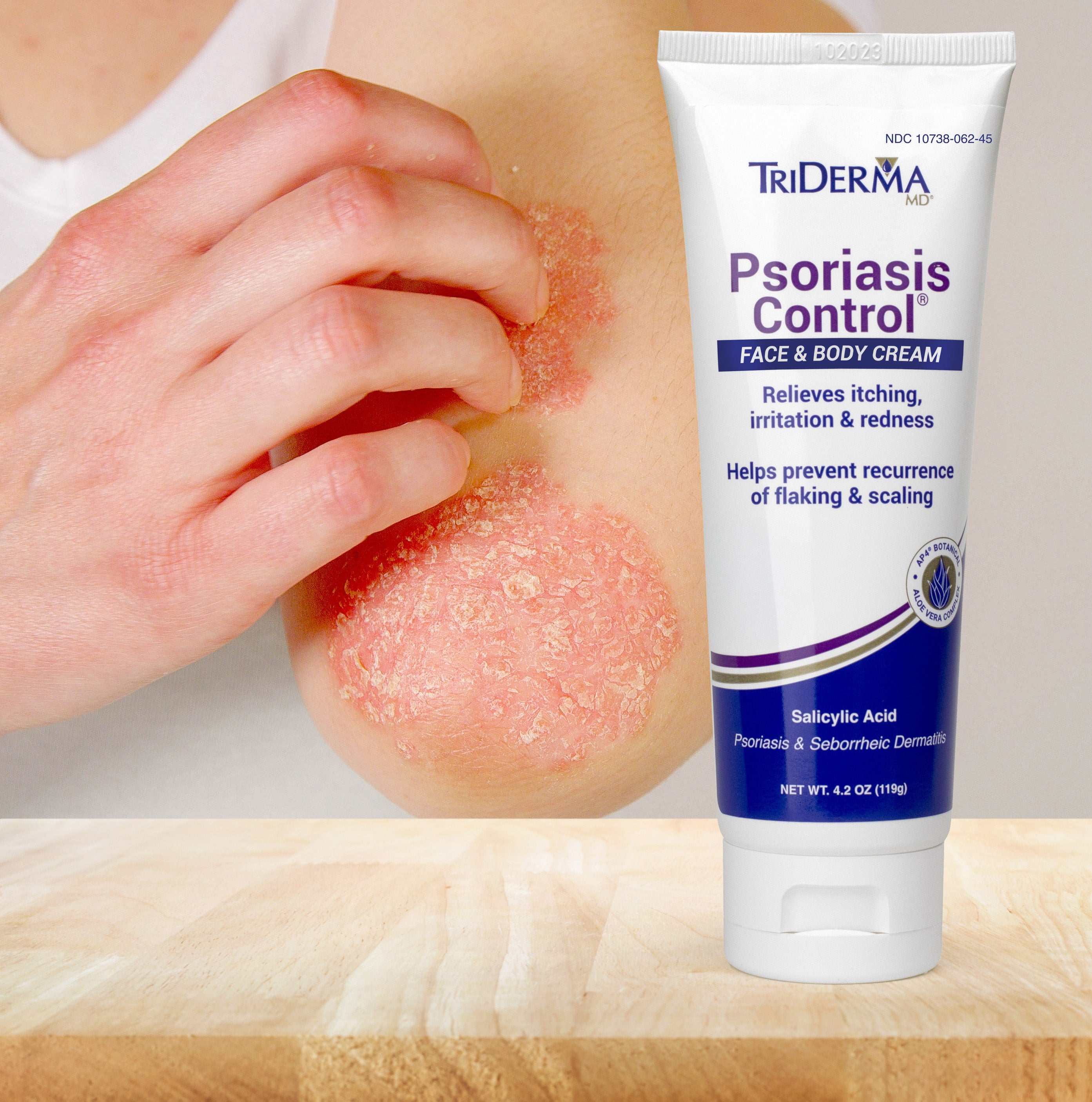 Psoriasis – TriDerma MD