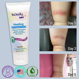 TriDerma Baby Healing All-Purpose Cream