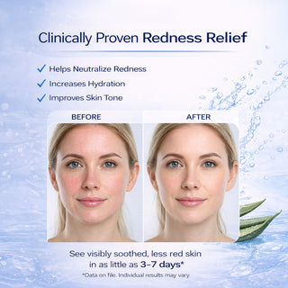 Facial Redness Relief Gentle Face Cream