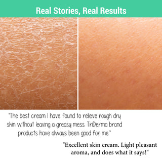 Diabetics Dry Skin Defense Moisturizing Cream
