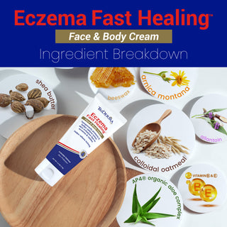 Eczema Cream for Face & Body, Itch Relief for Dry Sensitive Skin, Steroid-Free Moisturizer with Colloidal Oatmeal & Aloe, Helps Support Skin Barrier, Dermatologist Tested, 4.2 oz