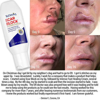 Scar Block Silicone Gel for New and Old Scars