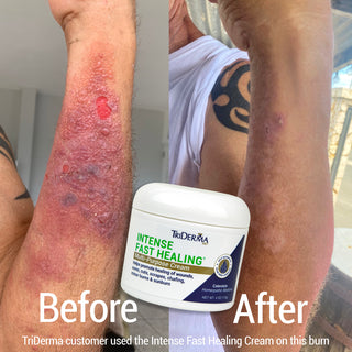 Intense Fast Healing Cream
